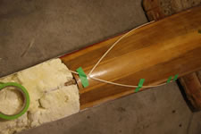 edging-for-prosthesis-3